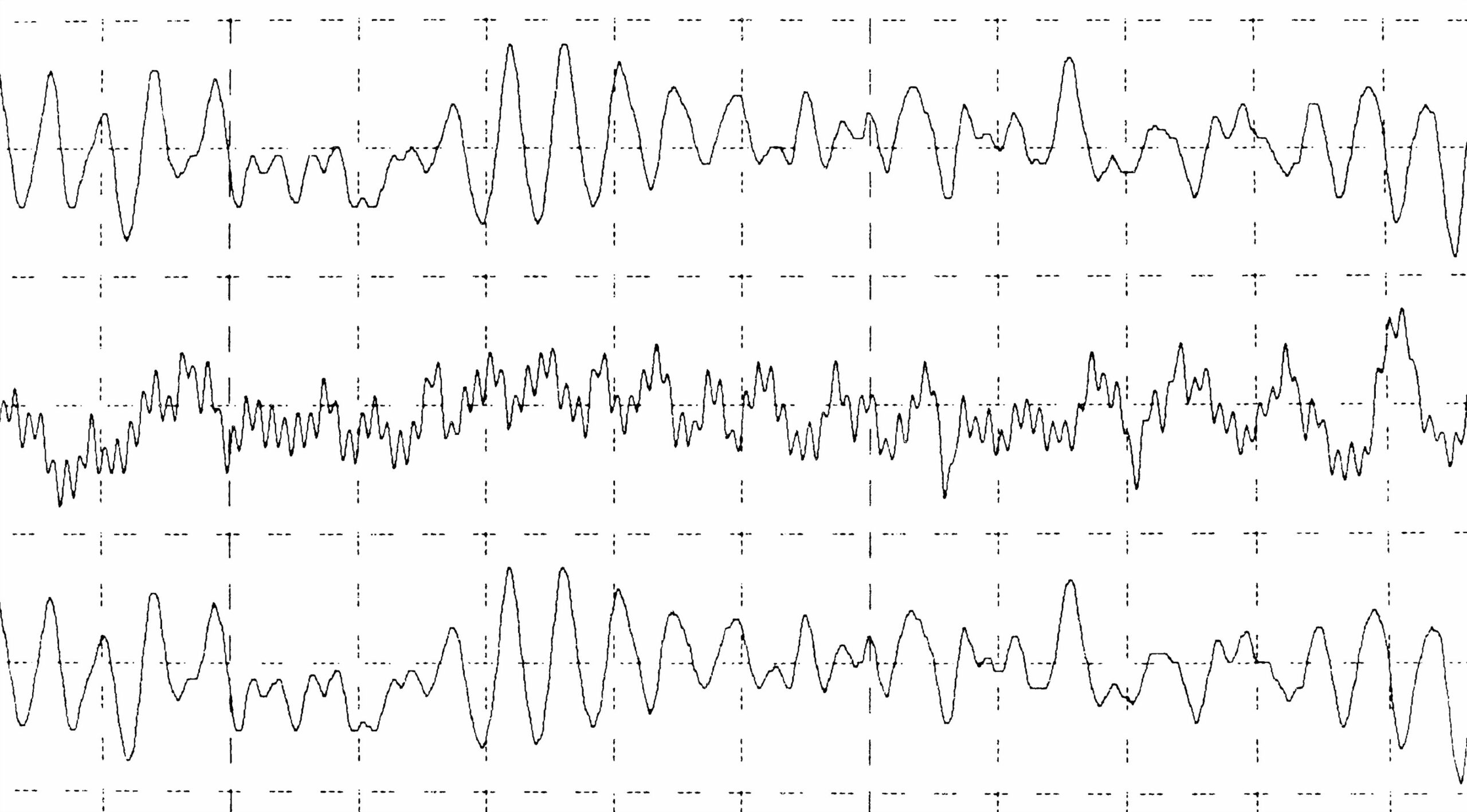 graph brain wave EEG isolated on white background